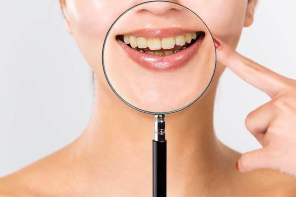 Magnified yellow teeth on woman