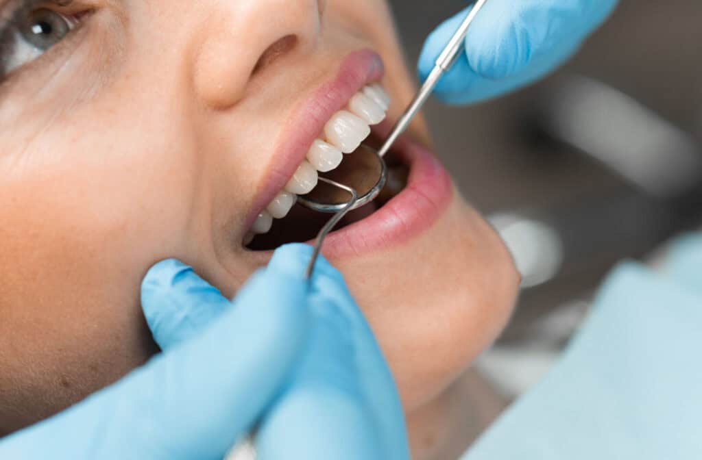 An out-of-frame dentist using a handheld mirror and scraper to examine a smiling patient's teeth for gum recession.