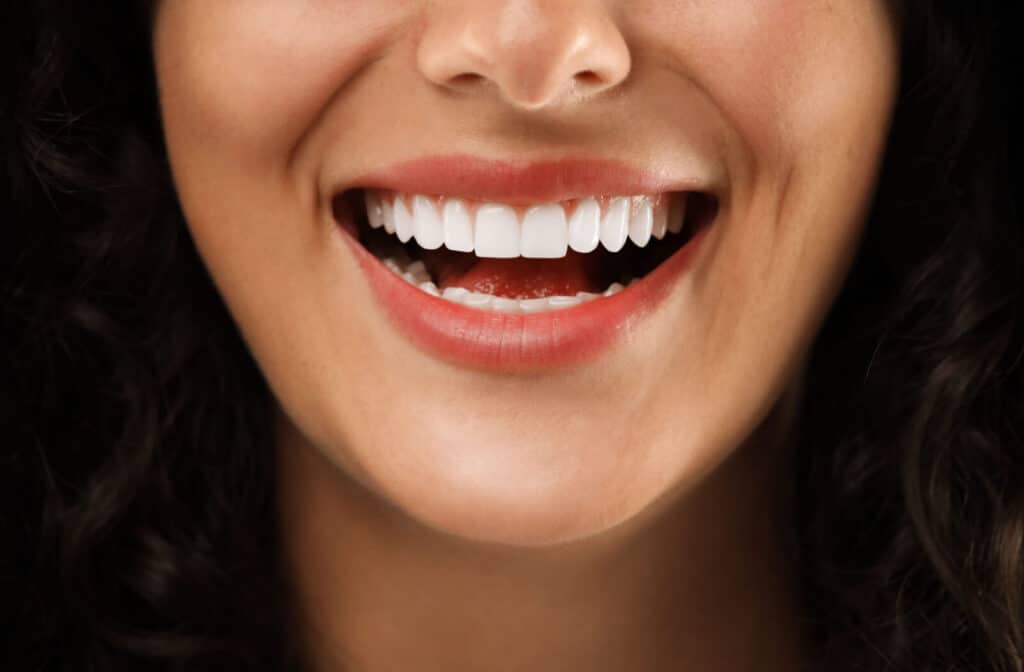 A closeup of someone smiling with ceramic dental crowns