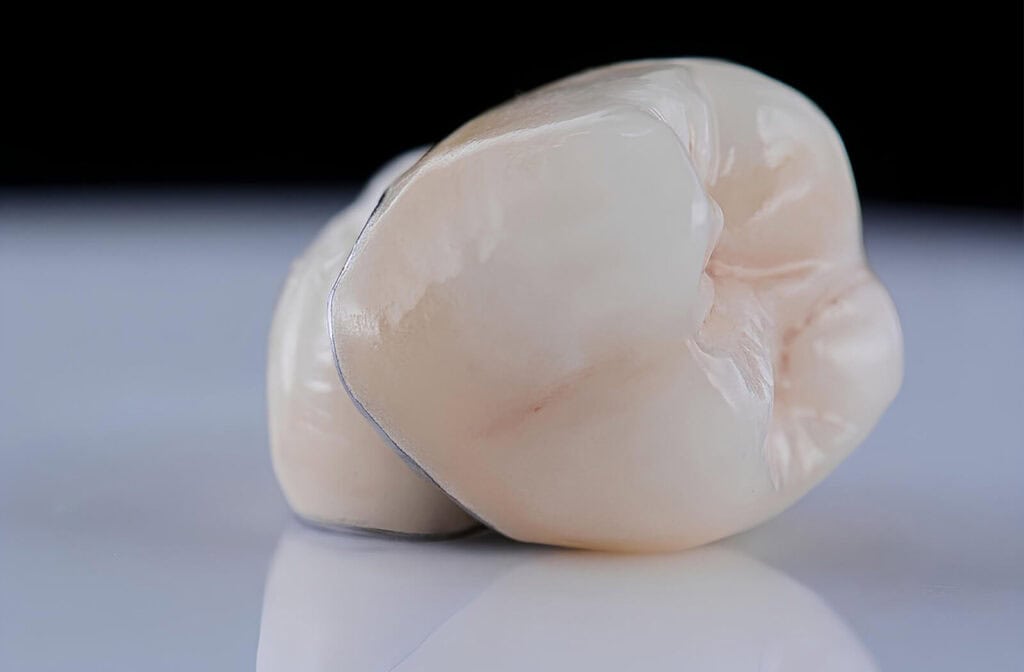 A close up of a set of ceramic crowns used in dental restoration
